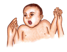Babkin Palmomental Reflex