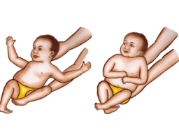 Moro Embrace Reflex